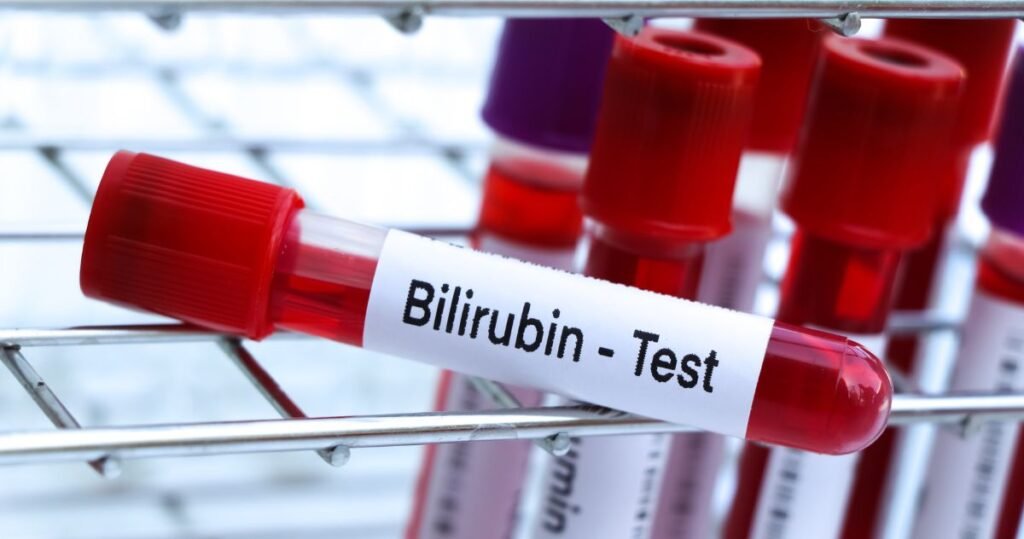 Normal Bilirubin Levels in Newborns 